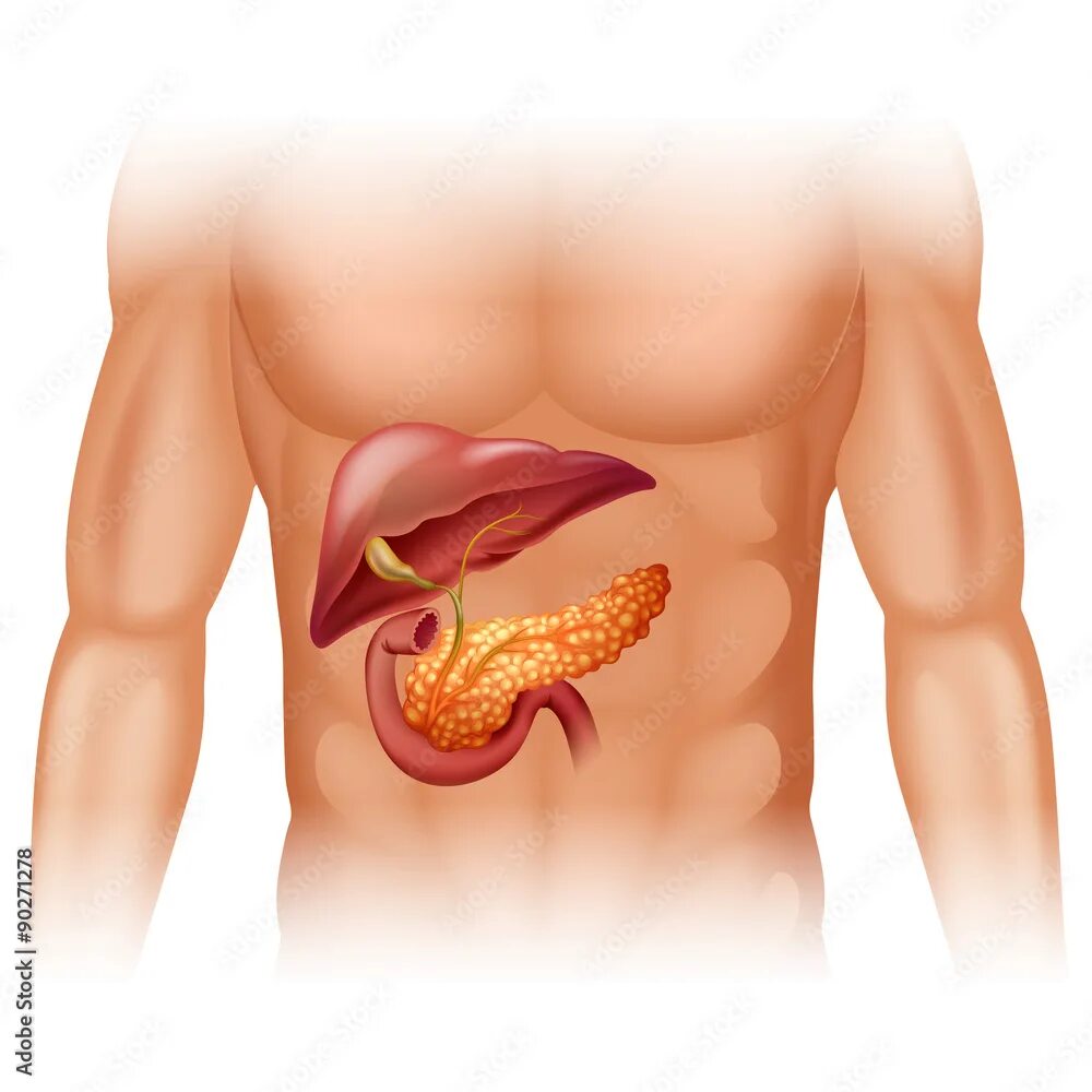 Поджелудочная железа симптомы фото Pancreas cancer diagram in detail Векторне зображення Stock Adobe Stock