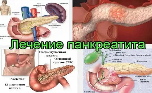 Поджелудочная железа симптомы фото Алкогольный панкреатит симптомы