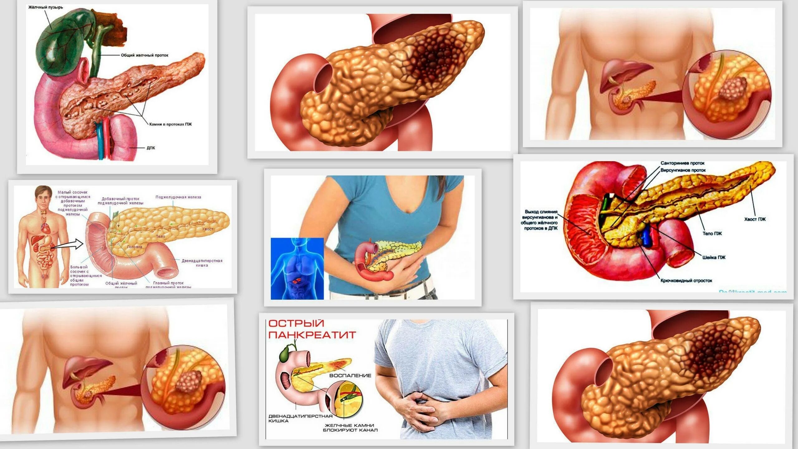 Поджелудочная железа симптомы и лечение фото Панкреатит у человека симптомы