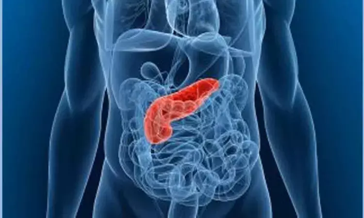 Поджелудочный камень фото Women with polycystic ovary syndrome at higher risk of pancreatic cancer: JAMA