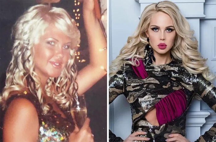 Погребняк до и после пластики фото Мария погребняк -мать троих детей до и после пластики- список пластических опера