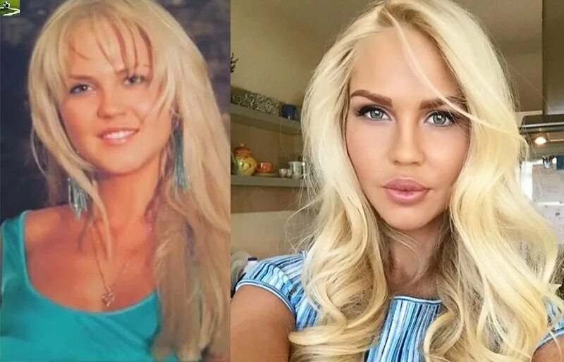 Погребняк до и после пластики фото Мария Погребняк, как выглядит и чем занимается супруга нападающего Павла Погрябн