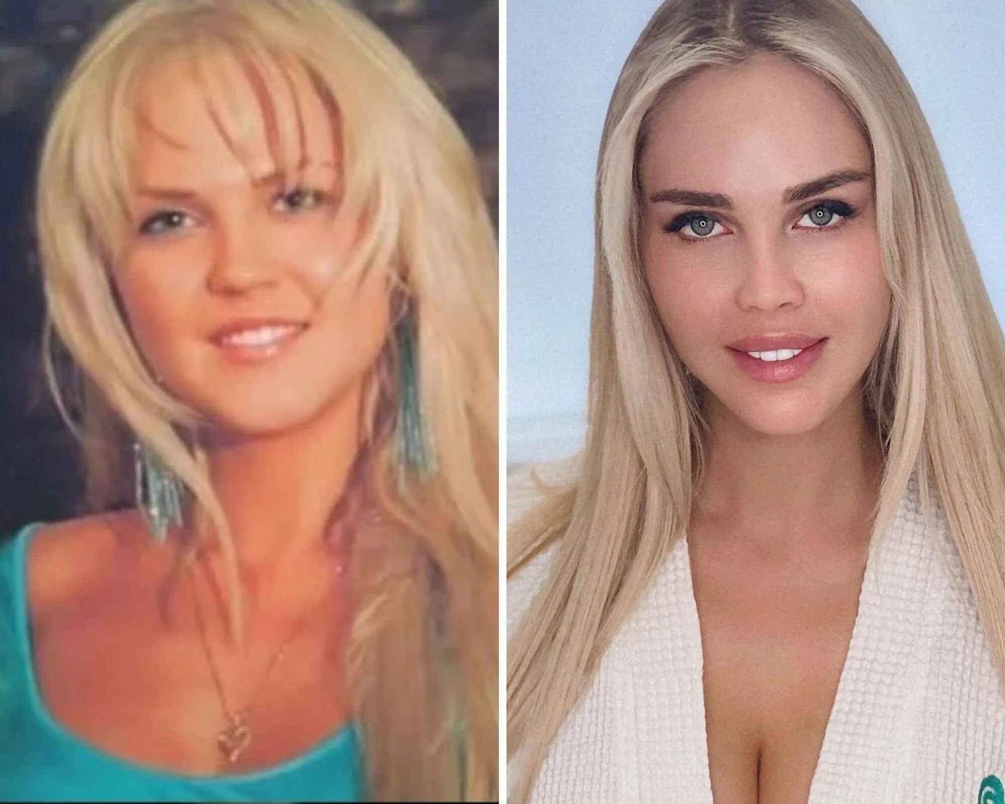 Погребняк до и после пластики фото Маша погребняк до пластики до и после - Арт Минск.ру