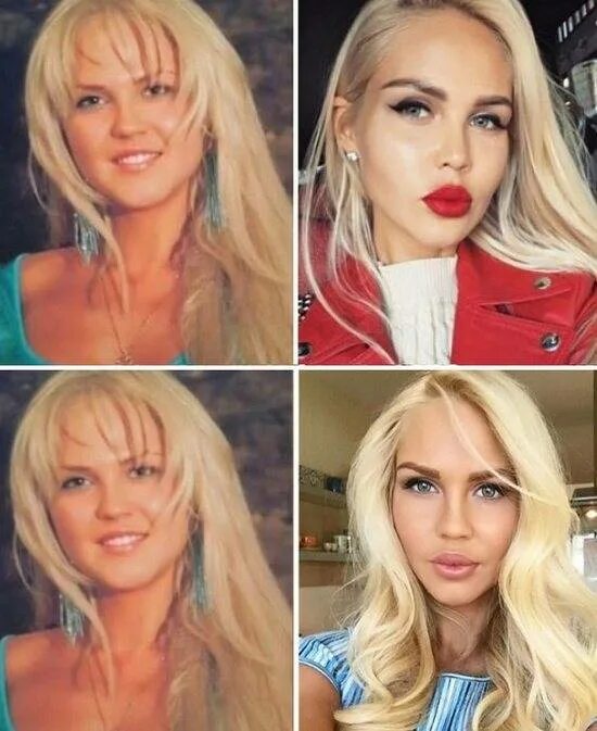 Погребняк до и после пластики фото Мария Погребняк до и после пластических операций, фото и видео