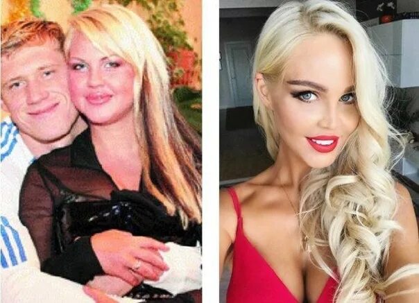 Погребняк до и после пластики фото Ну прям мечта каждой 2023 Безумные приколы ВКонтакте