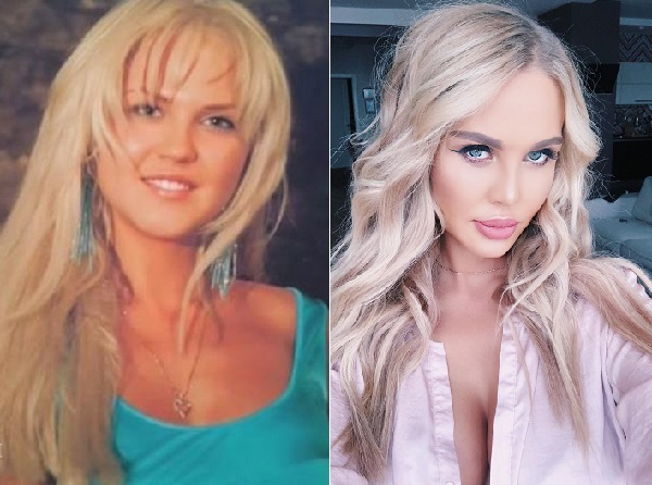 Погребняк до и после пластики фото Из грязи в князи. Жёны футболистов после преображения Женщина в поиске Дзен