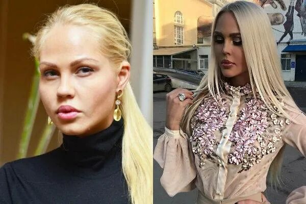 Погребняк до и после пластики фото Мария Погребняк до и после пластических операций, фото и видео