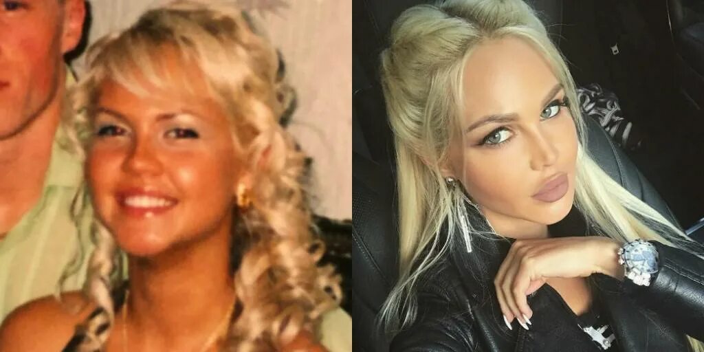 Погребняк до и после пластики фото Мария Погребняк до и после пластических операций, фото и видео