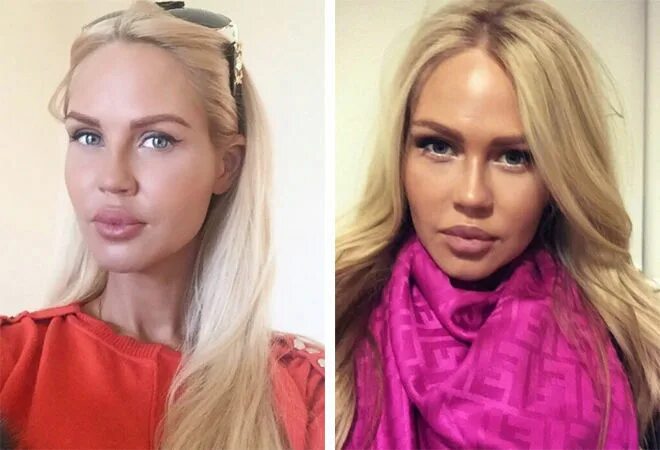 Погребняк до и после пластики фото Вернули как было: звезды, которые решились на преображение, а потом передумали -