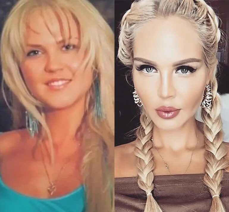 Погребняк до и после пластики фото Всего несколько лет прошло: звезды, которых не узнать на старых фото