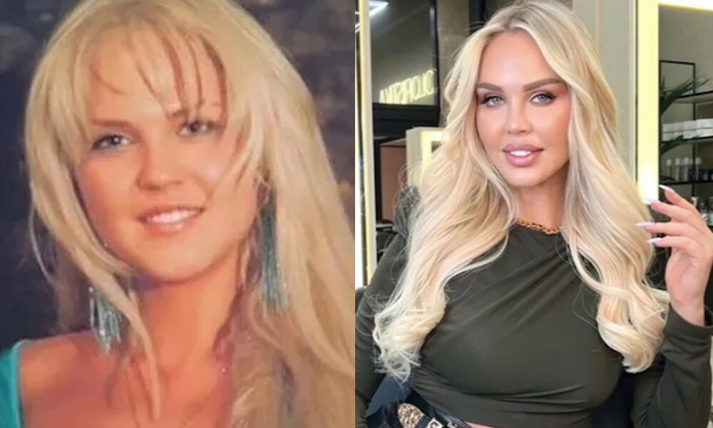 Погребняк до и после пластики фото Погребняк до и после пластики фото: найдено 90 картинок