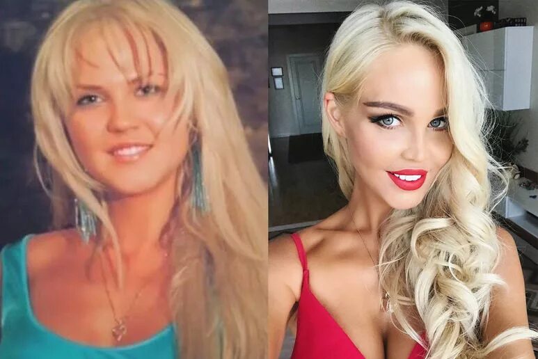 Погребняк до и после пластики фото Жены российских футболистов до и после пластики - Я Покупаю