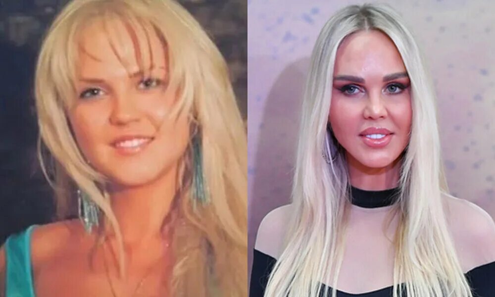 Погребняк до и после пластики фото "Жадность фраера сгубила!" 5 российских звезд, которые сильно зазнались и считаю