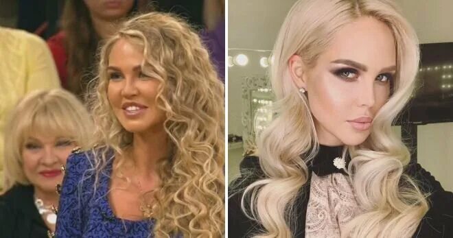 Погребняк до и после пластики фото Чудеса пластики: 15 звезд российского Instagram до и после ИНТЕРЕСНЫЕ ФАКТЫ Дзен