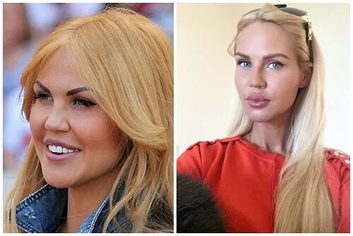 Погребняк до и после пластики фото It’s like moral rape": Maria Pogrebnyak decided to fight the haters The wife of 