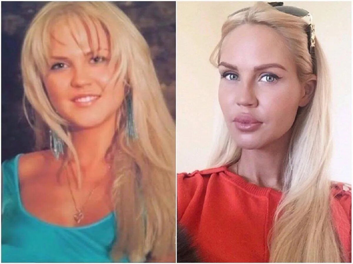 Погребняк до и после пластики фото Изменили лишь одну деталь в лице": Как визуально изменились 15 известных певиц и