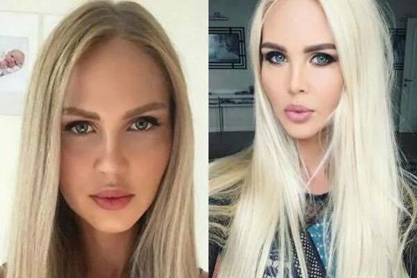 Погребняк до и после пластики фото Мария Погребняк до и после пластических операций, фото и видео