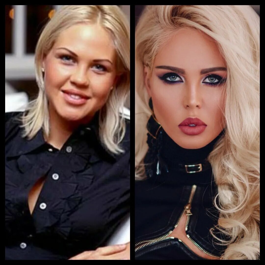 Погребняк до и после пластики фото Носы знаменитостей, превратившиеся в носики Логика будней Дзен