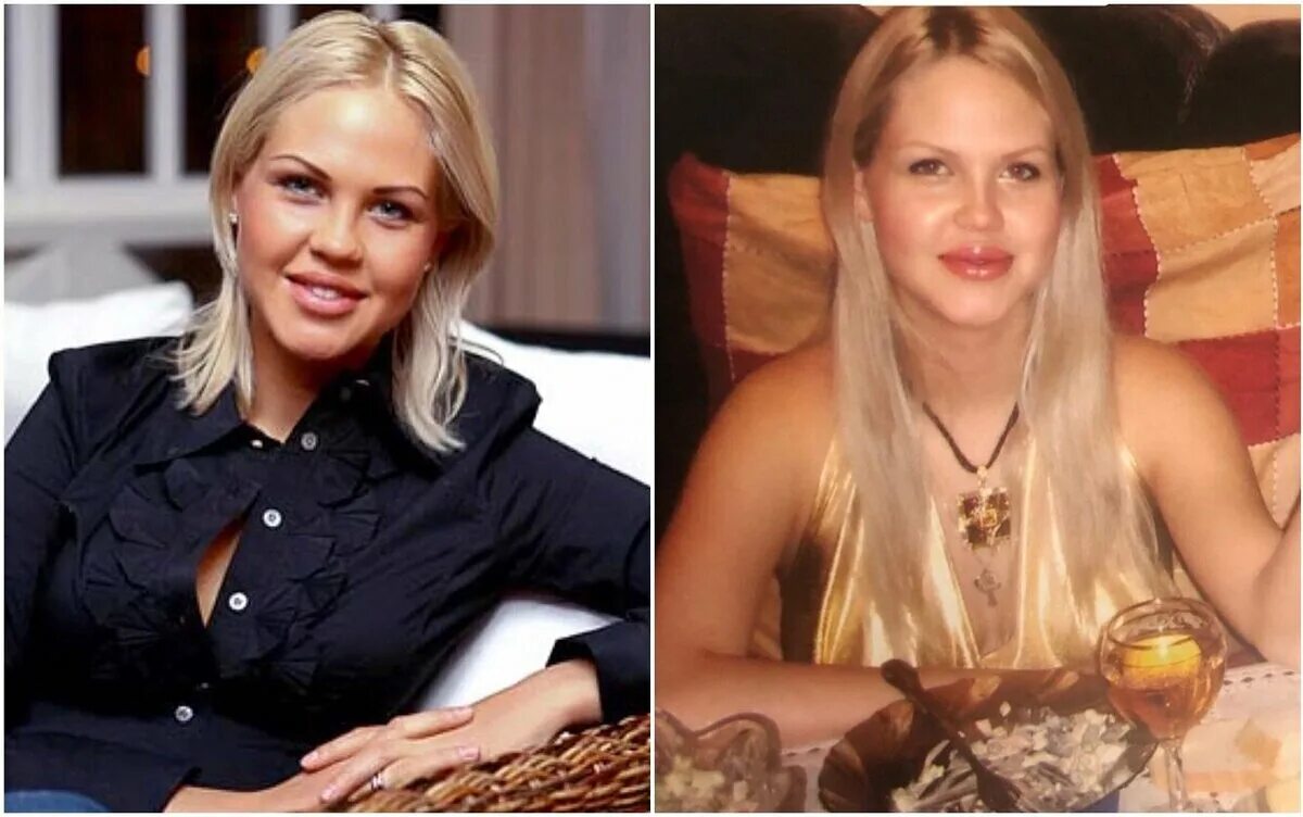 Погребняк до и после пластики фото Знаменитые девушки, которые после пластики стали похожи на кукол Знаменитости и 