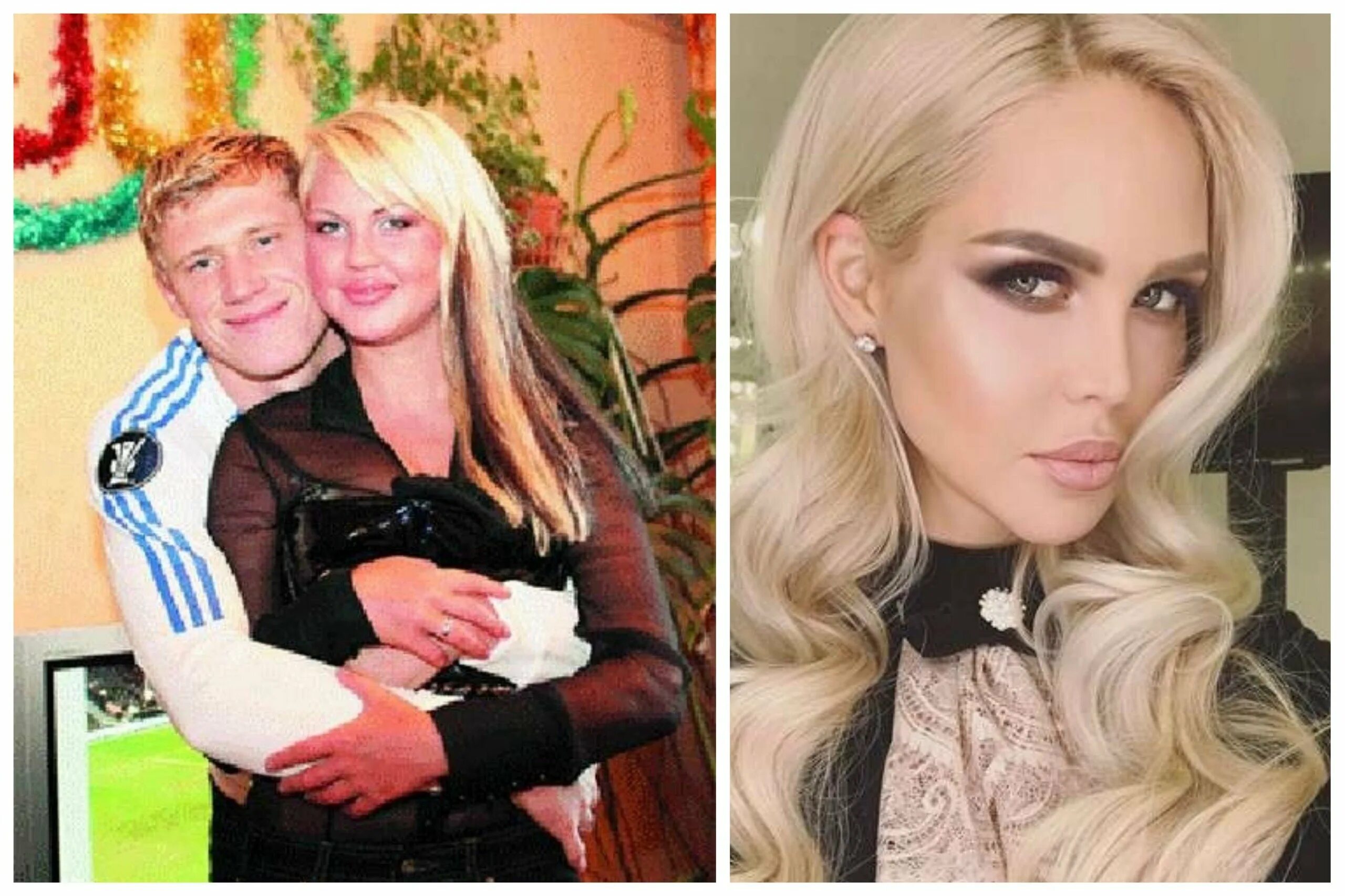 Погребняк до и после пластики фото Погребняк до и после пластики - найдено 90 картинок