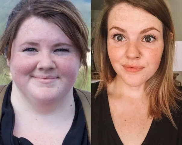 Похудение лица до и после фото The face changes dramatically after losing weight. 2022 ★ ГТО ★ ГОТОВ К ТРУДУ И 