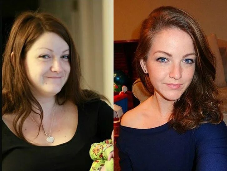 Похудение лица до и после фото Looks truly gorgeous! 16 Amazing Weight Loss Before and After Transformations!