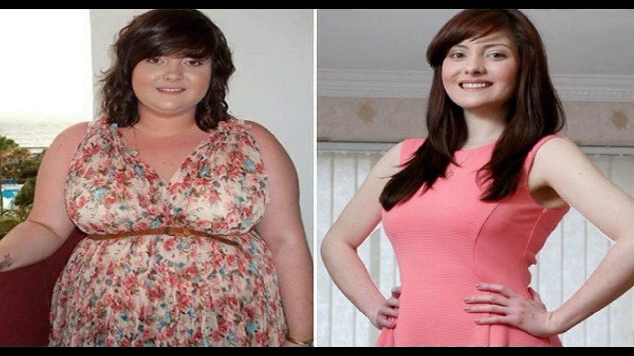 Похудение лица фото SHE LOST 52 KILOGRAMS WITHOUT DIET THIS IS HER SECRET! - YouTube