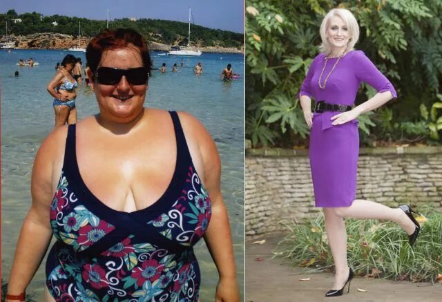 Похудение с 45 фото Huge Weight Loss Success Stories. Part 2 (44 pics) - Izismile.com