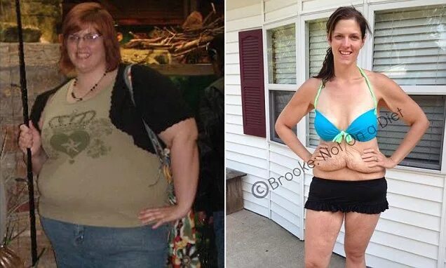 My heart attack was the best thing that ever happened to me': Obese mother, 43, 