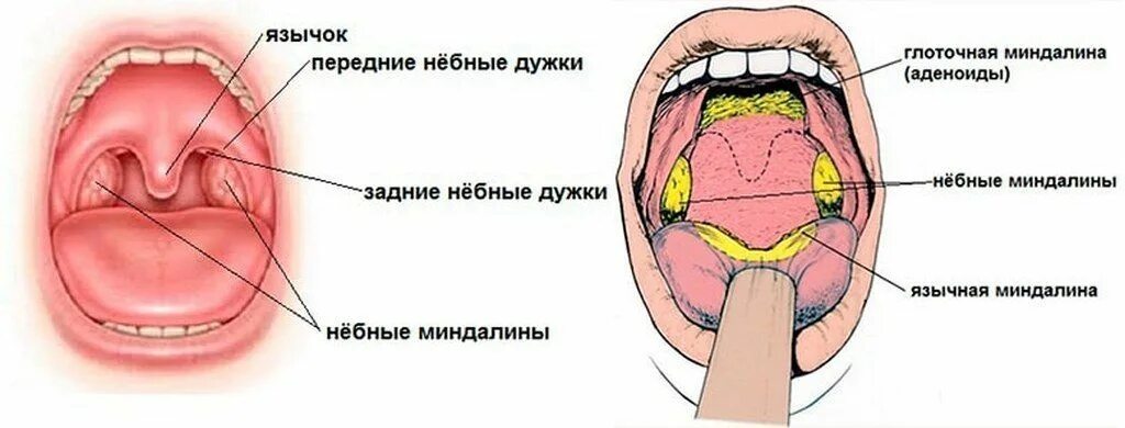 Показать фото горла Как выглядит больное горло: правила осмотра и признаки заболеваний