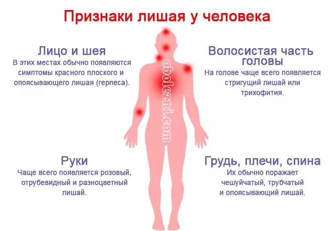 Показать фото как выглядит лишай Герпес на теле у ребенка: рекомендации педиатра и 6 этапов развития болезни