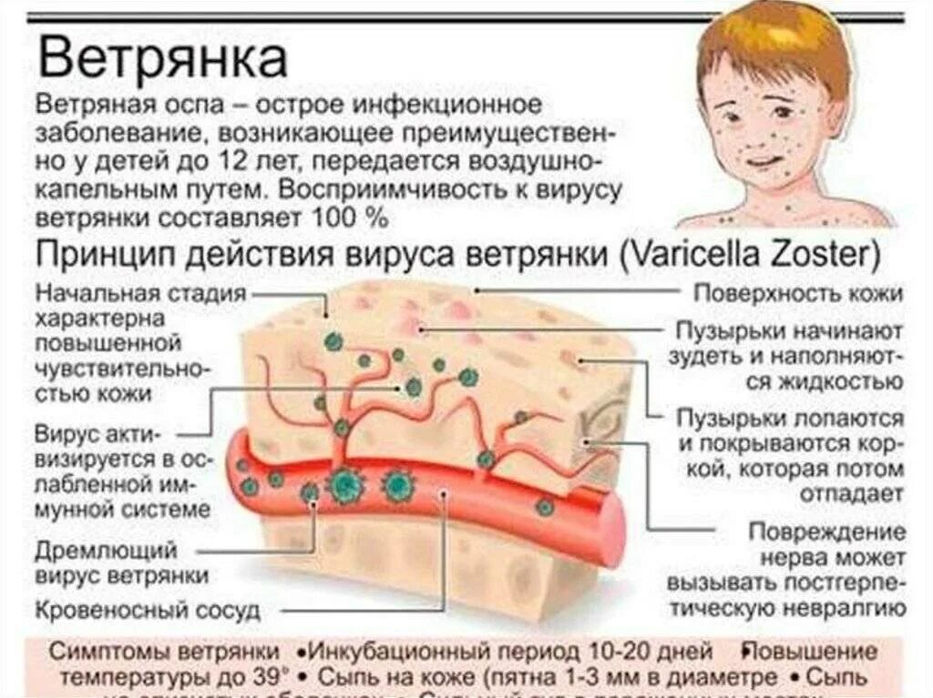 Показать фото как выглядит ветрянка Этиология сыпи