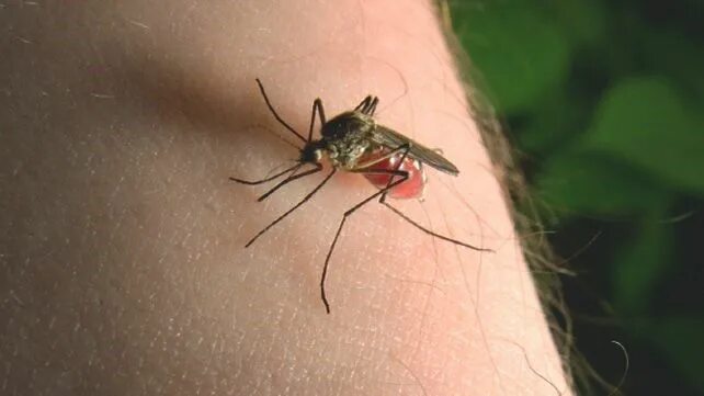 Показать фото укусов насекомых 09 Remédios Caseiros para Tratar Picadas de Mosquitos Mosquito bite symptoms, Mo