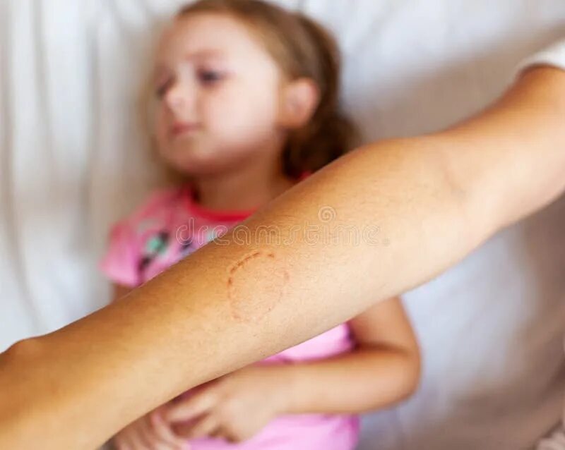 Показать как выглядит укус Toddler Female Biting the Arm of the Mother Stock Image - Image of problem, chil