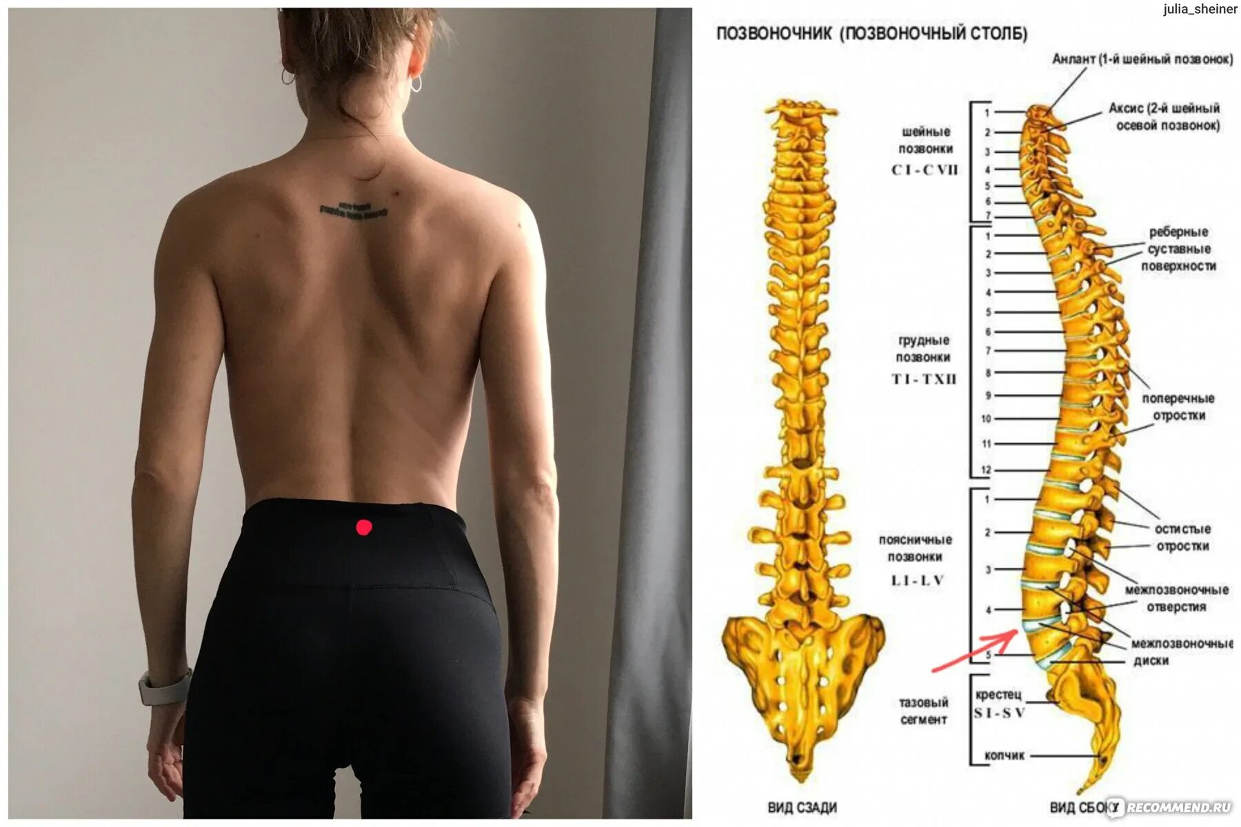 Показать поясничный отдел позвоночника на человеке фото УЗИ поясничного отдела позвоночника - "УЗИ поясничного отдела позвоночника показ