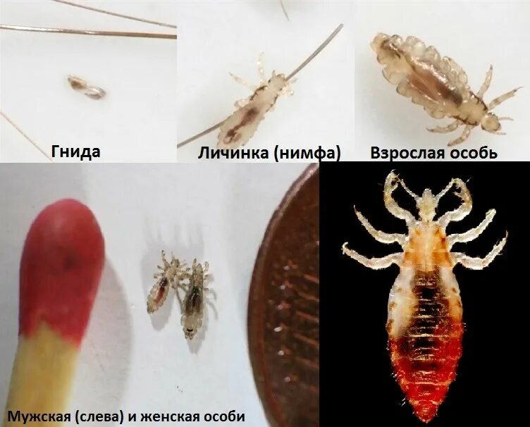 Покажи фотку как выглядят вши Какой у педикулеза инкубационный период, через сколько вылупляются вши из гнид?