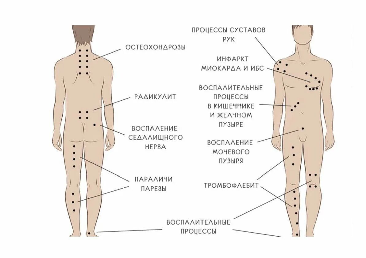 Покажи фото 5 точки К Новому году обновлю-ка я себя Я и здесь молчать не буду!!! Дзен