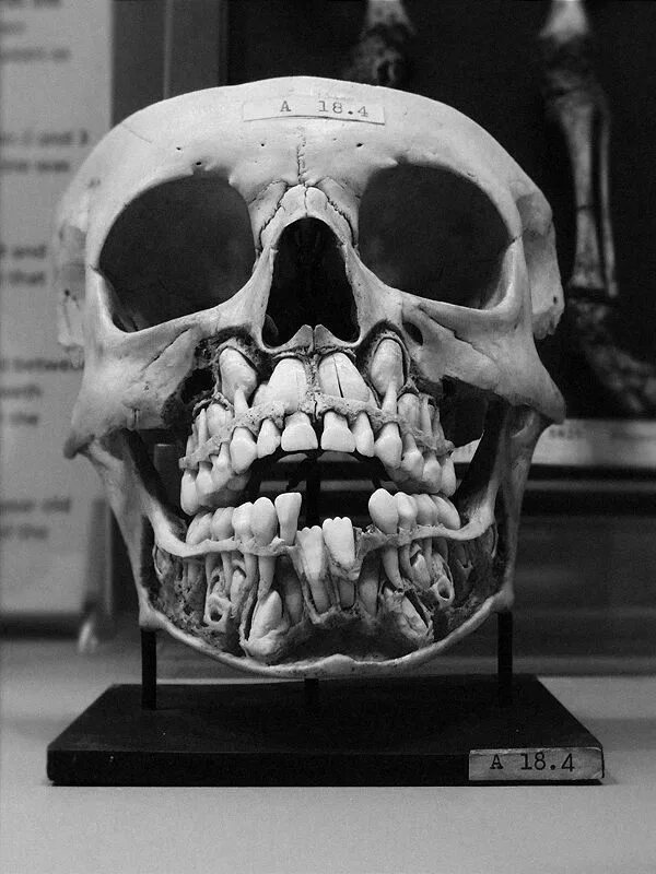 Покажи фото черепа арины глазуновой Pin by Darl Gnau on skullssss Childs skull, Human anatomy and physiology, Skull