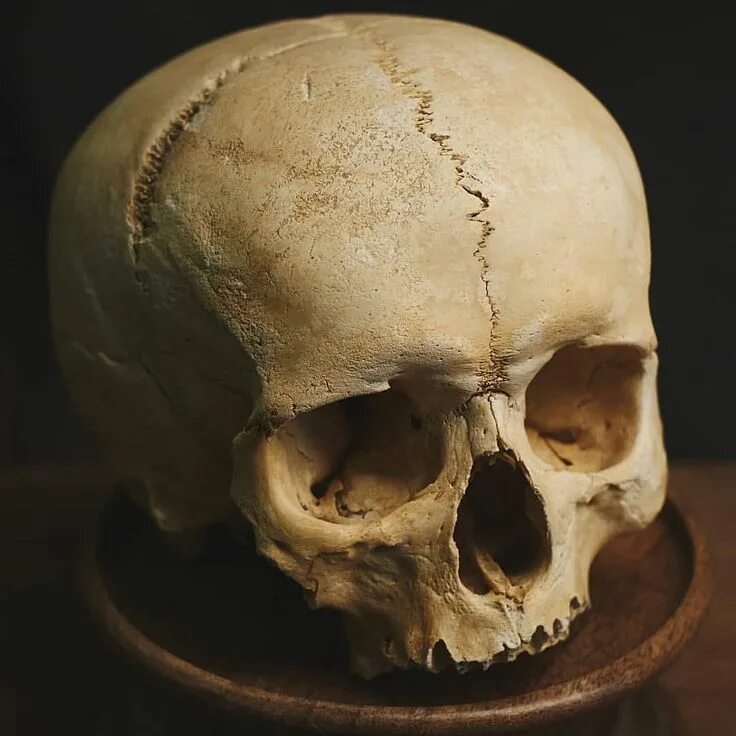 Покажи фото черепа арины глазуновой This skull displays a nice metopic suture on the frontal bone. NFS #oddities #cu