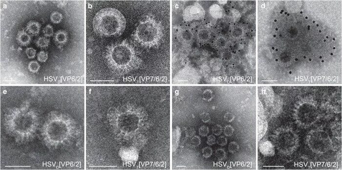 Покажи фото герпеса Electron micrographs of herpes simplex virus type 1 (HSV-1) amplicon... Download