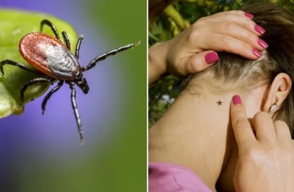 Покажи фото как выглядят клещи ❗ Rains and high grass led to an increase in tick bites More than 600 have been 