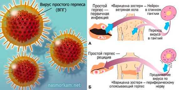 Покажи фото опоясывающего герпеса Вирус герпеса у собак: опасность, симптомы и проявление, лечение, профилактика, 