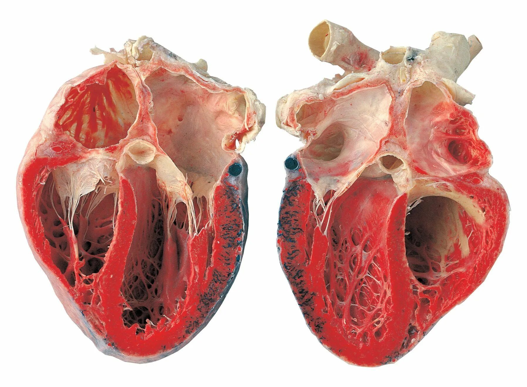 Покажи фото сердца Human heart, Anatomy, Science and nature