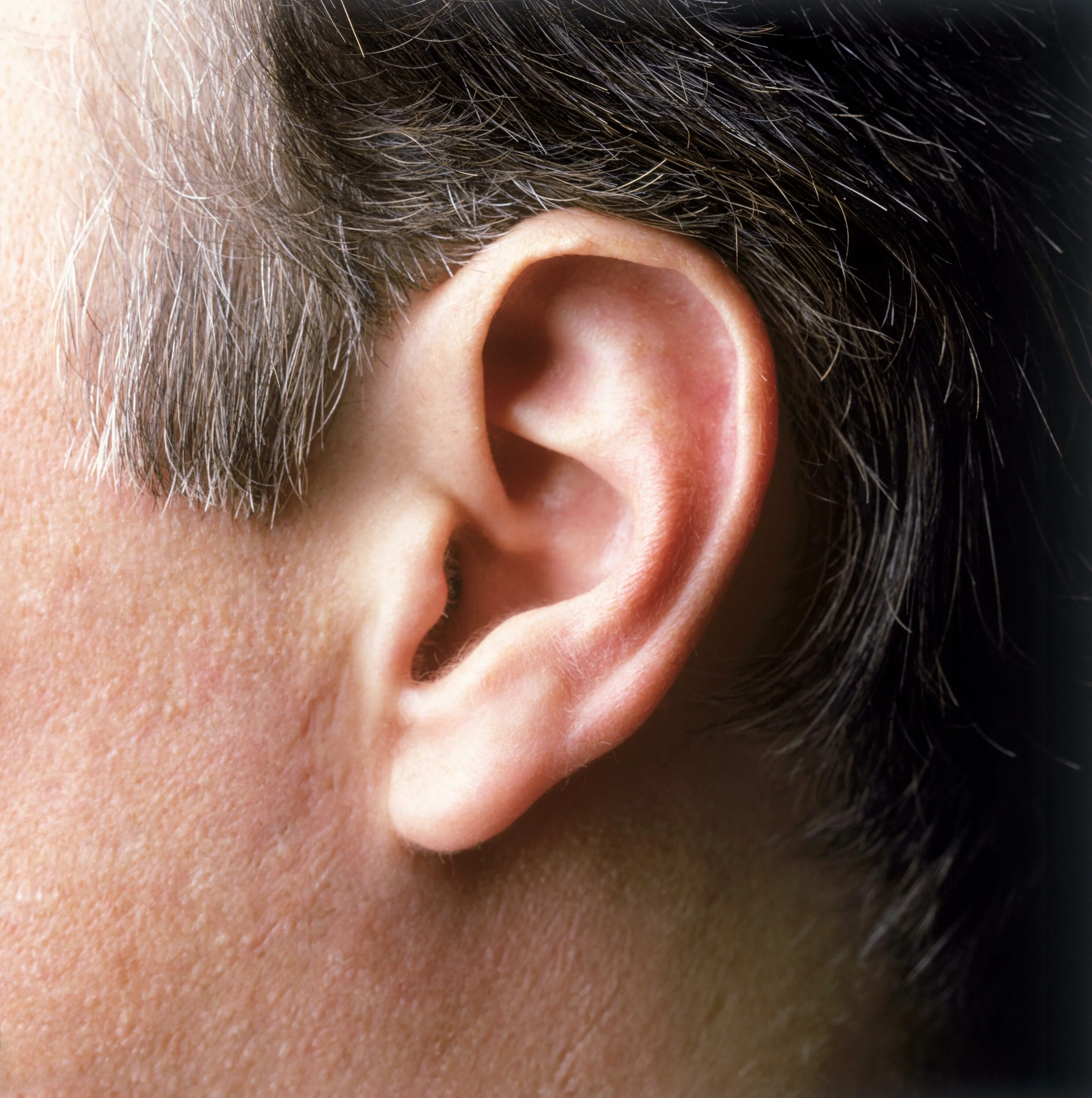 Покажи фото уха How researchers claim a crease in your ear could indicate you face a greater ris