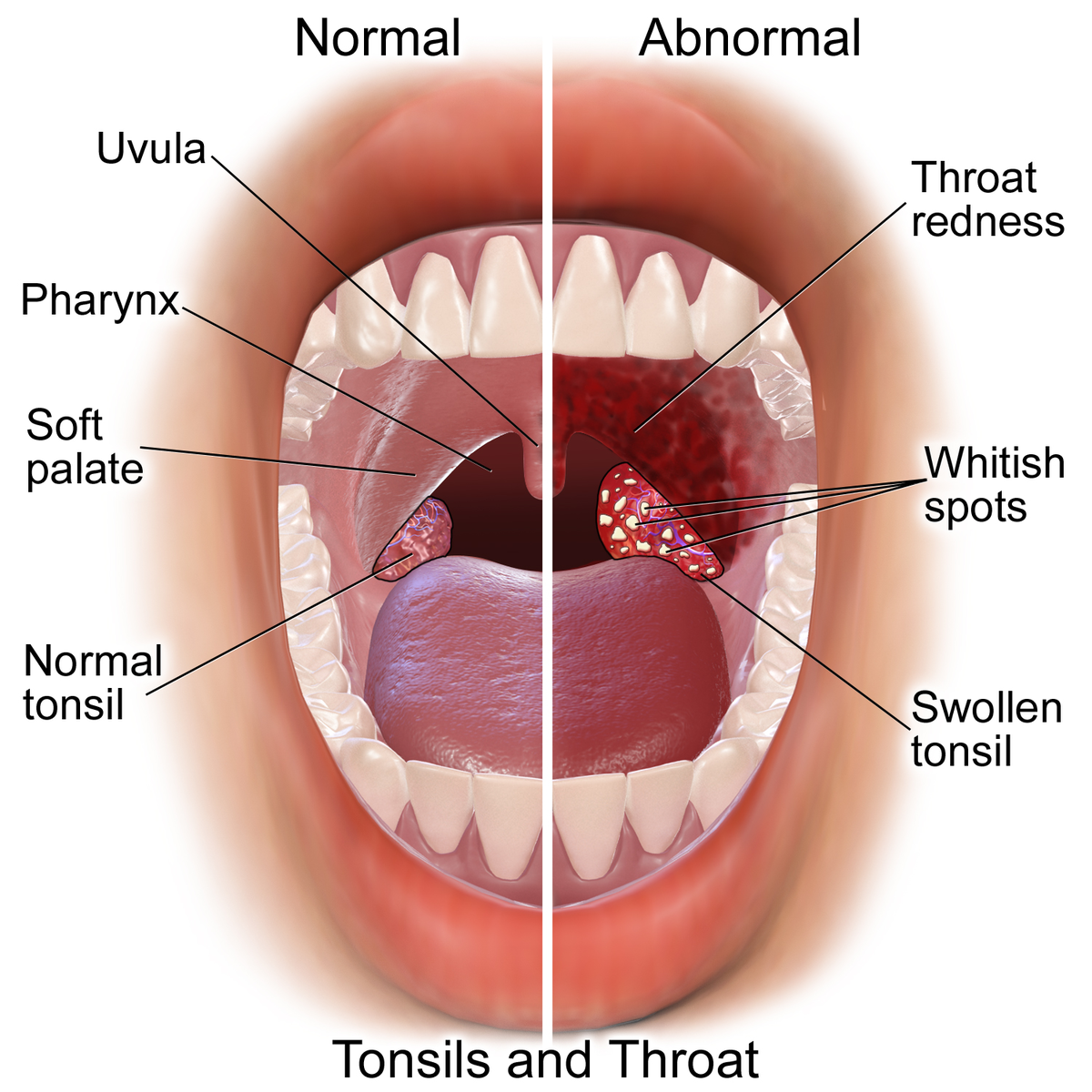 Покажи как выглядит горло File:Blausen 0860 Tonsils&Throat Anatomy.png - Wikipedia