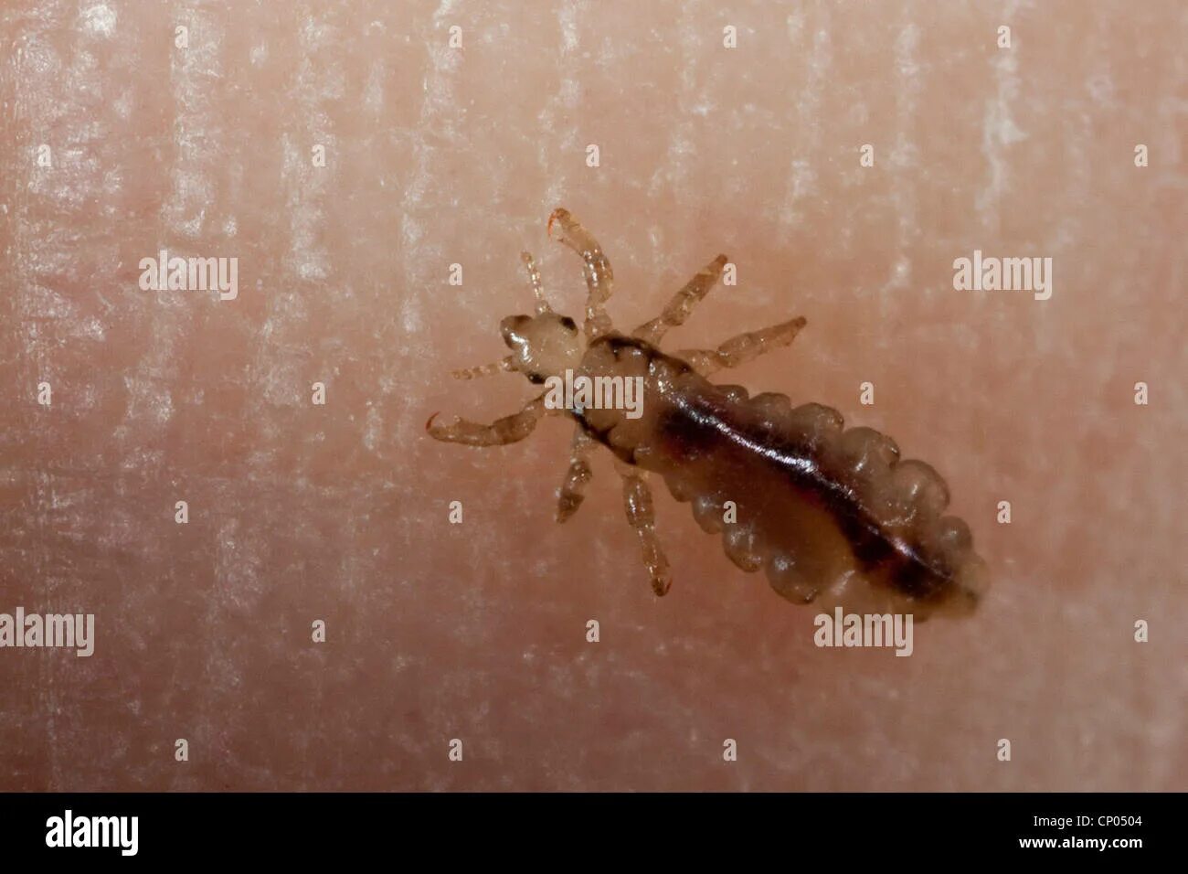 Покажи как выглядит вша Pediculus humanus humanus hi-res stock photography and images - Alamy