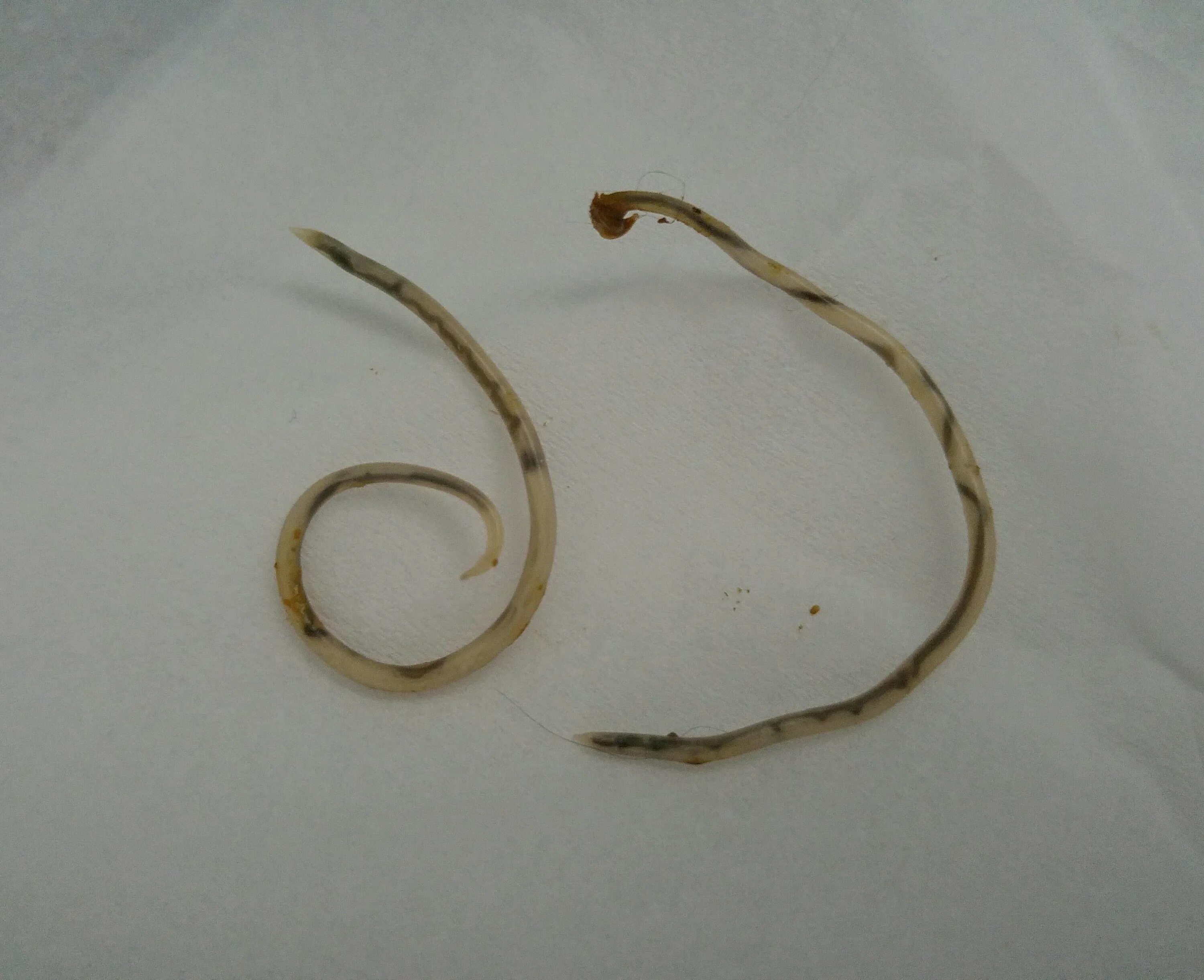 Покажи как выглядят глисты Острица (67 фото)