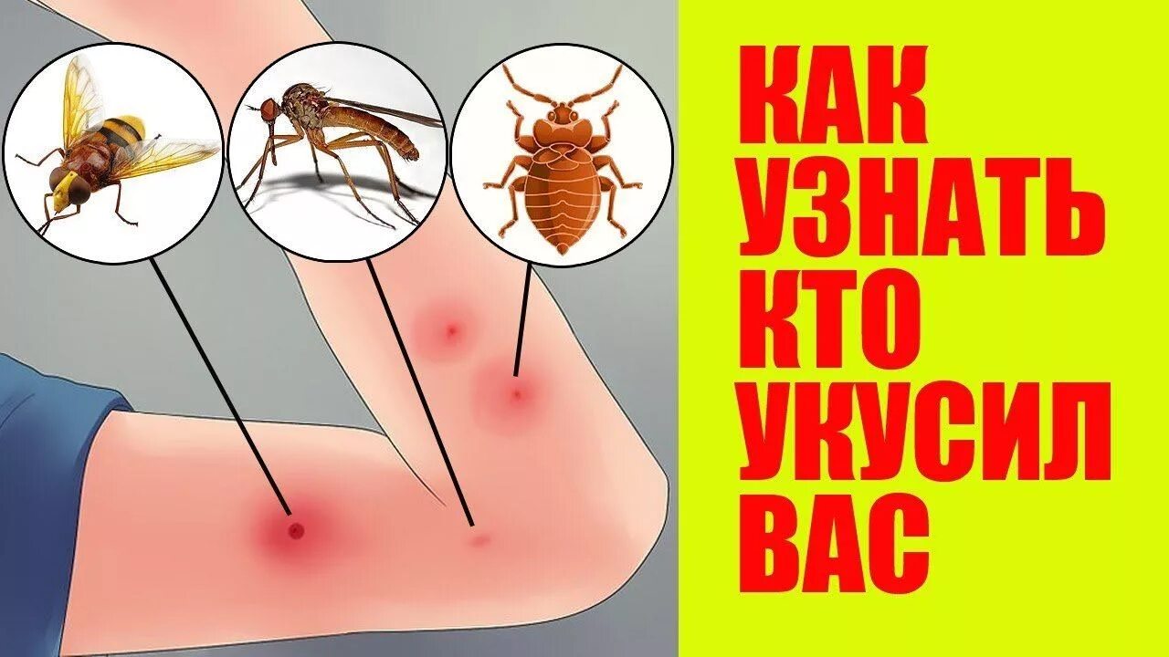 Покажи как выглядят укусы клопов Топ 10 Укусов Насекомых, о Которых вы Обязаны Знать. ФОТО - смотреть видео онлай