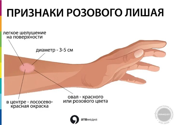 Покажи картинку как выглядит лишай DERMAQUEST " Розовый лишай Статьи Отзывы Купить