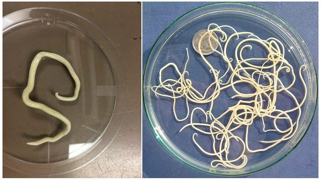 Покажи картинку как выглядят глисты Какие цветом паразиты: найдено 90 изображений